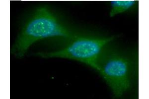 ICC/IF analysis of UBE2L6 in HeLa cells line, stained with DAPI (Blue) for nucleus staining and monoclonal anti-human UBE2L6 antibody (1:100) with goat anti-mouse IgG-Alexa fluor 488 conjugate (Green). (UbcH8/Ube2L6 (AA 1-152) 抗体)