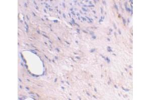 Immunohistochemical staining of human bladder tissue using AP30081PU-N ARMER antibody at 2 μg/ml. (ARL6IP1 抗体  (C-Term))
