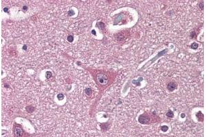 Human Brain, Cortex: Formalin-Fixed, Paraffin-Embedded (FFPE) (PPAT 抗体  (AA 42-278))