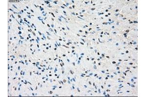 Image no. 2 for anti-Synovial Sarcoma, X Breakpoint 2 (SSX2) antibody (ABIN1501161) (SSX2 抗体)