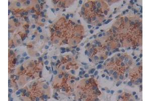 DAB staining on IHC-P; Samples: Human Stomach Tissue (LOXL4 抗体  (AA 479-756))