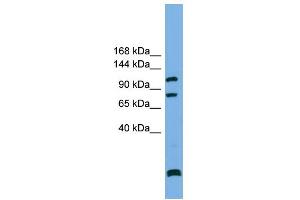 WB Suggested Anti-PPP6R1 Antibody Titration: 0.