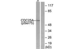 Western Blotting (WB) image for anti-Cell Division Cycle 25 Homolog A (S. Pombe) (CDC25A) (pSer75) antibody (ABIN2888378) (CDC25A 抗体  (pSer75))