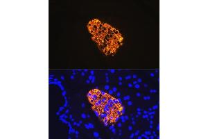 Immunofluorescence analysis of rat pancreas using Insulin Rabbit mAb (ABIN7267886) at dilution of 1:100 (40x lens). (Insulin 抗体)