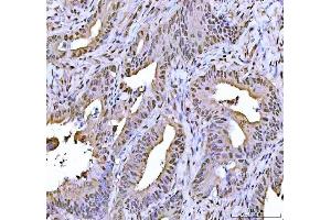 IHC analysis of FEN1 using anti-FEN1 antibody (ABIN7601617). (FEN1 抗体  (AA 4-300))
