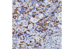 Immunohistochemistry of paraffin-embedded mouse spleen using MMP25 antibody (ABIN7268422) at dilution of 1:100 (40x lens).