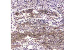 Immunohistochemistry (IHC) image for anti-Creatine Kinase, Brain (CKB) (AA 7-381) antibody (ABIN5692824)