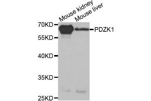 Western Blotting (WB) image for anti-PDZ Domain Containing 1 (PDZK1) antibody (ABIN1876509) (PDZK1 抗体)