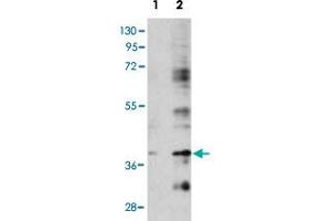 Western blot analysis of BIRC7 (arrow) using rabbit BIRC7 polyclonal antibody . (BIRC7 抗体  (C-Term))