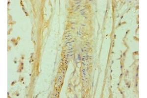 Immunohistochemistry of paraffin-embedded human prostate tissue using ABIN7145641 at dilution of 1:100 (BAMBI 抗体  (AA 21-152))