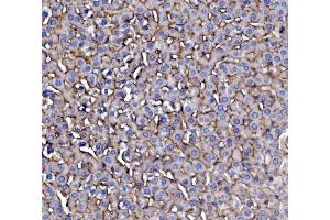 IHC analysis of EGFR using anti-EGFR antibody (ABIN7601478). (EGFR 抗体  (AA 36-497))