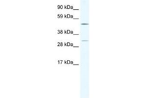 CAMK4 antibody (20R-1131) used at 1. (CAMK4 抗体  (C-Term))