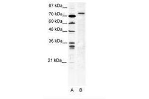 Image no. 1 for anti-Tripartite Motif Containing 9 (TRIM9) (C-Term) antibody (ABIN202749) (TRIM9 抗体  (C-Term))
