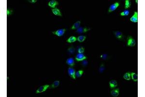 Immunofluorescence staining of Hela cells with ABIN7151367 at 1:166, counter-stained with DAPI. (CD39 抗体  (AA 316-474))