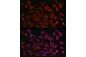 Immunofluorescence analysis of HeLa cells using Cytokeratin 8 Rabbit pAb (ABIN3021287, ABIN3021288, ABIN3021289, ABIN1513142 and ABIN1514287) at dilution of 1:50 (40x lens).