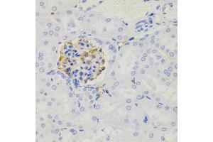 Immunohistochemistry of paraffin-embedded mouse kidney using NPHS1 antibody (ABIN5971560) (40x lens). (Nephrin 抗体)