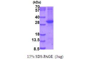 SDS-PAGE (SDS) image for Mitogen-Activated Protein Kinase Kinase 6 (MAP2K6) (AA 53-314) protein (His tag) (ABIN6387535) (MAP2K6 Protein (AA 53-314) (His tag))