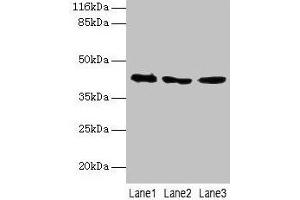 Western blot All lanes: ATXN3 antibody at 2 μg/mL Lane 1: 293T whole cell lysate Lane 2: Mouse brain tissue Lane 3: MCF-7 whole cell lysate Secondary Goat polyclonal to rabbit IgG at 1/10000 dilution Predicted band size: 42, 36, 40, 21 kDa Observed band size: 42 kDa (Ataxin 3 抗体  (AA 1-288))