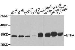 Western blot analysis of extracts of various cell lines, using ETFA antibody. (ETFA 抗体  (AA 1-333))