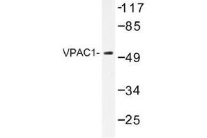 Image no. 1 for anti-Vasoactive Intestinal Peptide Receptor 1 (VIPR1) antibody (ABIN317871) (VIPR1 抗体)