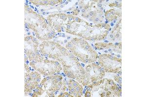 Immunohistochemistry of paraffin-embedded mouse kidney using TARS antibody (ABIN5974207) at dilution of 1/100 (40x lens). (TARS 抗体)