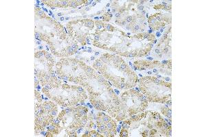 Immunohistochemistry of paraffin-embedded mouse kidney using TARS antibody (ABIN5974207) at dilution of 1/100 (40x lens). (TARS 抗体)