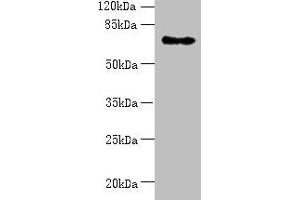 Western blot All lanes: ZNF133 antibody at 5 μg/mL + Hela whole cell lysate Secondary Goat polyclonal to rabbit IgG at 1/10000 dilution Predicted band size: 74, 63, 67 kDa Observed band size: 74 kDa (ZNF133 抗体  (AA 1-210))