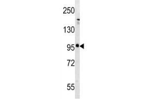 Western blot analysis of mGLUR5 antibody and mouse brain tissue lysate