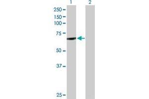 Western Blotting (WB) image for anti-Cytochrome P450, Family 11, Subfamily B, Polypeptide 1 (CYP11B1) (AA 1-574) antibody (ABIN514849)