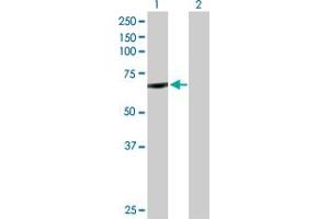 Western Blot analysis of CYP11B1 expression in transfected 293T cell line by CYP11B1 MaxPab polyclonal antibody. (CYP11B1 抗体  (AA 1-574))