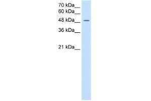 WB Suggested Anti-SLC16A8 Antibody Titration:  2. (MCT3 抗体  (Middle Region))