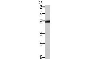 Western Blot analysis of Human normal liver tissue using FOXC1 Polyclonal Antibody at dilution of 1/400 (FOXC1 抗体)