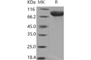 Interleukin 6 Signal Transducer (Gp130, Oncostatin M Receptor) (IL6ST) (Active) protein (His tag)