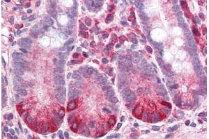 Human Small Intestine (formalin-fixed, paraffin-embedded) stained with IL8RB antibody ABIN337037 at 2. (CXCR2 抗体)