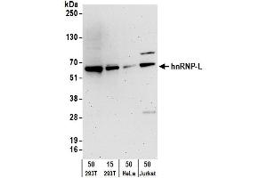 Western Blotting (WB) image for anti-Heterogeneous Nuclear Ribonucleoprotein L (HNRNPL) (C-Term) antibody (ABIN7795592)