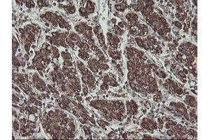 Image no. 6 for anti-Family with Sequence Similarity 164, Member A (FAM164A) antibody (ABIN1498198) (FAM164A 抗体)