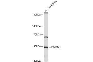 Western blot analysis of extracts of mouse kidney, using ZSWIM1 antibody (ABIN7271563) at 1:1000 dilution. (ZSWIM1 抗体  (AA 411-485))