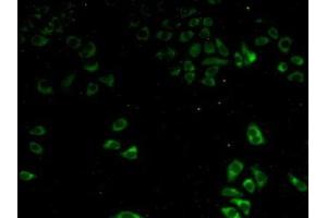 Detection of P4Ha2 in Human Hela Cells using Polyclonal Antibody to Prolyl-4-Hydroxylase Alpha Polypeptide II (P4Ha2) (P4HA2 抗体  (AA 207-520))
