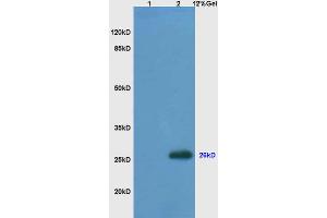 SDS-PAGE (SDS) image for anti-B-Cell CLL/lymphoma 2 (BCL2) (AA 101-160) antibody (ABIN723920)