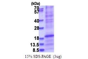 SDS-PAGE (SDS) image for Surfactant Protein D (SFTPD) (AA 224-375) protein (His tag) (ABIN5853770) (SFTPD Protein (AA 224-375) (His tag))