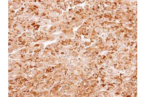 IHC-P Image Immunohistochemical analysis of paraffin-embedded CL1-5 xenograft, using AKR7A3, antibody at 1:100 dilution. (AKR7A3 抗体)