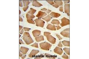 Formalin-fixed and paraffin-embedded human skeletal muscle reacted with PD2 Antibody (Center), which was peroxidase-conjugated to the secondary antibody, followed by DAB staining. (AMPD2 抗体  (AA 187-217))