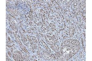 IHC analysis of TRMT6 using anti-TRMT6 antibody (ABIN7602138). (TRMT6 抗体  (AA 6-489))