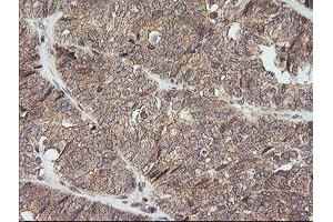 Image no. 2 for anti-NFKB Inhibitor Interacting Ras-Like 1 (NKIRAS1) antibody (ABIN1499742) (NKIRAS1 抗体)