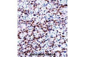 Immunohistochemistry (IHC) image for anti-Coiled-Coil Domain Containing 50 (CCDC50) antibody (ABIN2997838) (CCDC50 抗体)