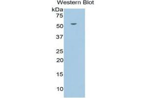 Western Blotting (WB) image for Nuclear Receptor Subfamily 3, Group C, Member 1 (Glucocorticoid Receptor) (NR3C1) ELISA Kit (ABIN6720464)