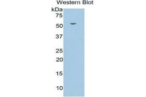 WB of Protein Standard: different control antibodies against Highly purified E. (Glucocorticoid Receptor ELISA 试剂盒)