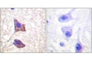Immunohistochemistry analysis of paraffin-embedded human brain tissue, using CD130/gp130 (Ab-782) Antibody.