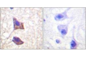 Immunohistochemistry analysis of paraffin-embedded human brain tissue, using CD130/gp130 (Ab-782) Antibody. (CD130/gp130 抗体  (AA 748-797))