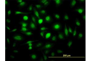 Immunofluorescence of monoclonal antibody to ZWINT on HeLa cell. (ZWINT 抗体  (AA 1-277))